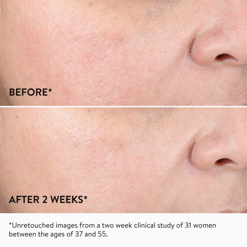 15% Glycolic Acid Overnight Glow Peel - Image 3